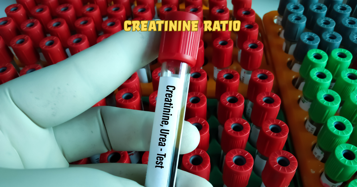 BUN/Creatinine Ratio